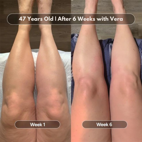 Vera™ Anti-Cellulite Massage Oil