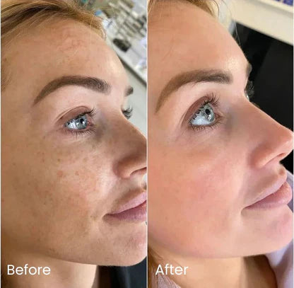 Jiyu™ Korean Toner Pads