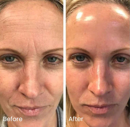 Jiyu™ Korean Toner Pads